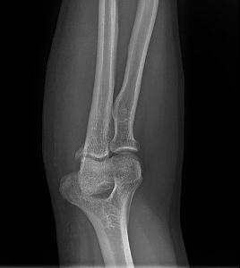 Photo Credit: Sethoscope